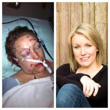 stabbing victim lives and shares her story